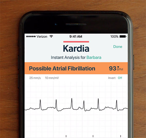 Smart device app screen related to possible atrial fibrillation