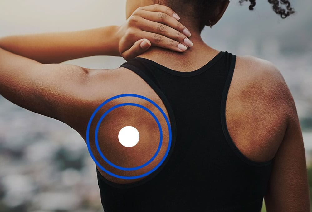 Where to place TENS pads