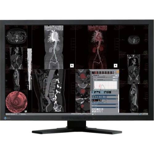 eizo radiforce mx241w