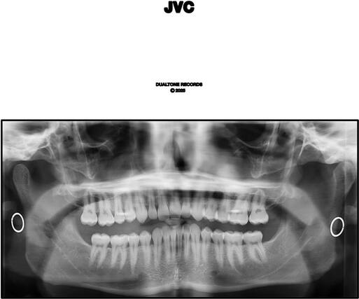 JVC
DUALTONE RECORDS
© 2025