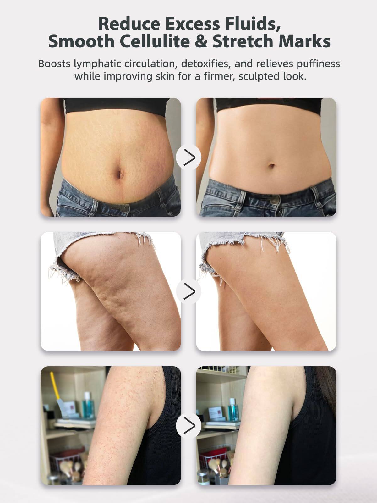 Reduce Excess Fluids, Smooth Cellulite & Stretch Marks

Boosts lymphatic circulation, detoxifies, and relieves puffiness while improving skin for a firmer, sculpted look.