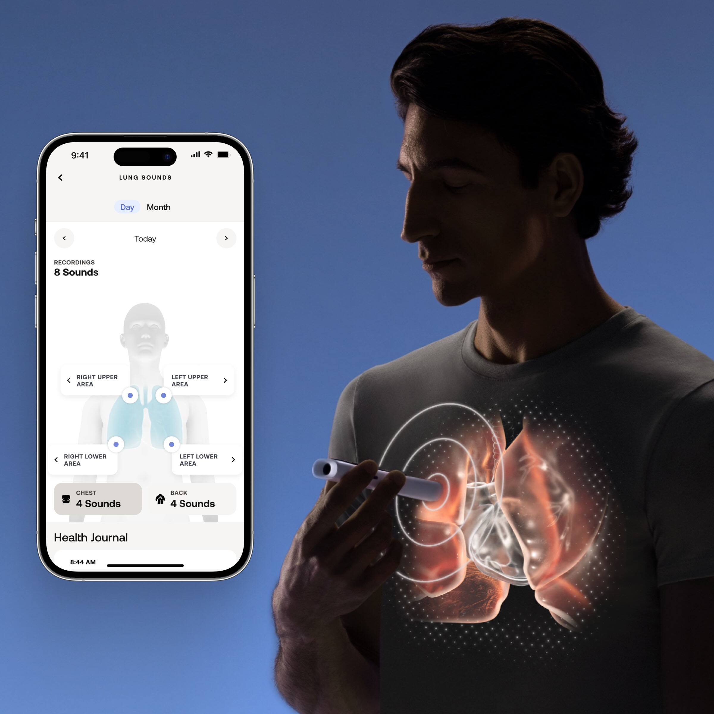 media item thumbnail