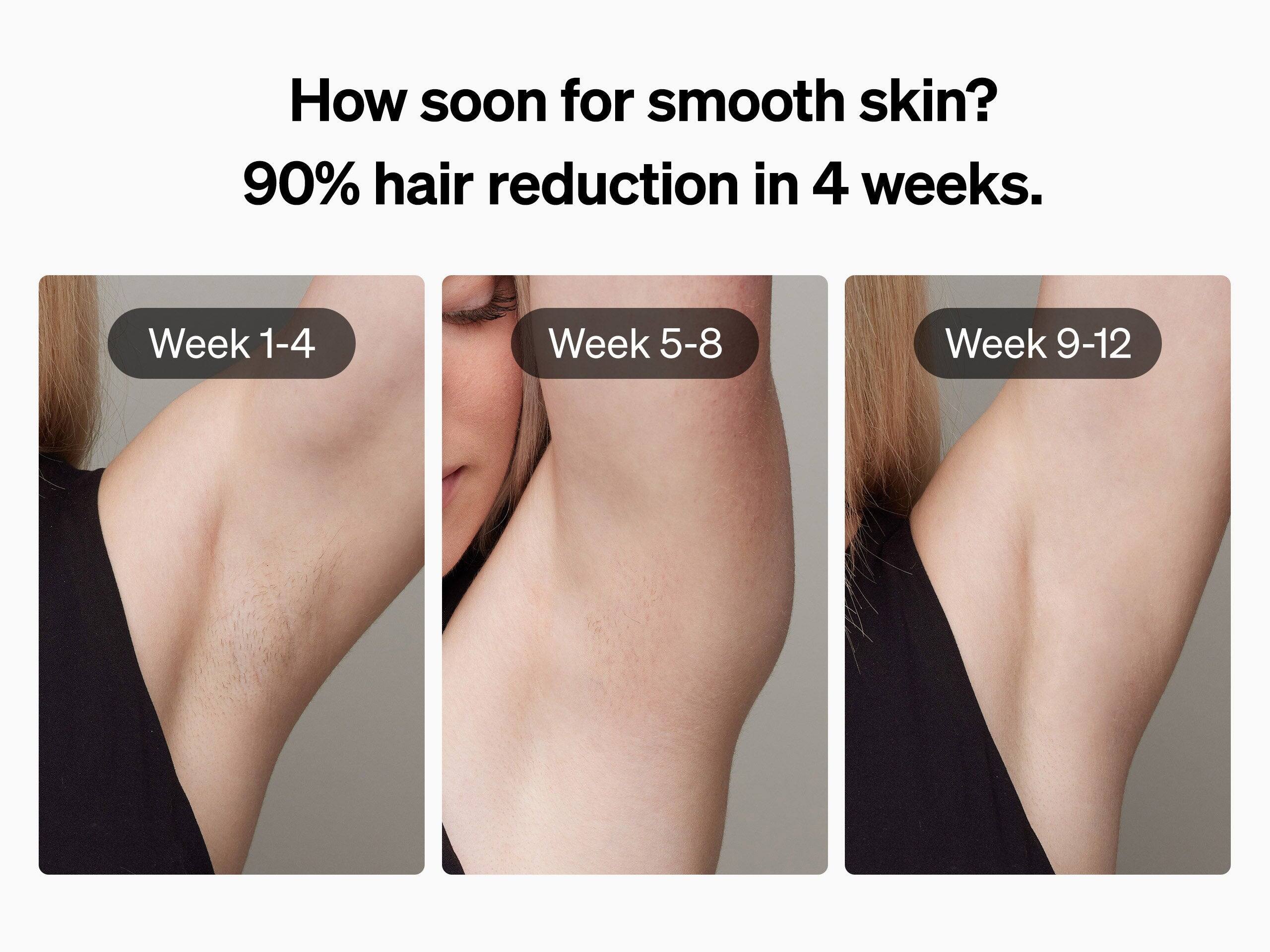 How soon for smooth skin? 90% hair reduction in 4 weeks.

Week 1-4
Week 5-8
Week 9-12