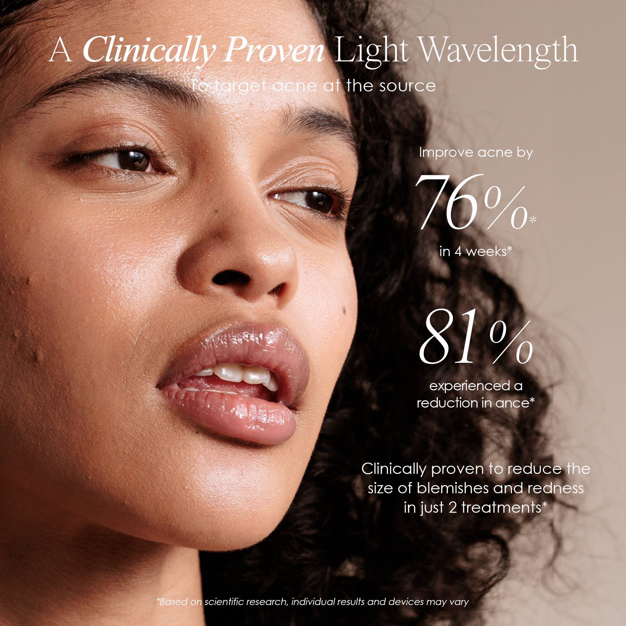 A Clinically Proven Light Wavelength To target acne at the source

Improve acne by 76% in 4 weeks*

81% experienced a reduction in acne*

Clinically proven to reduce the size of blemishes and redness in just 2 treatments*

*Based on scientific research, individual results and devices may vary