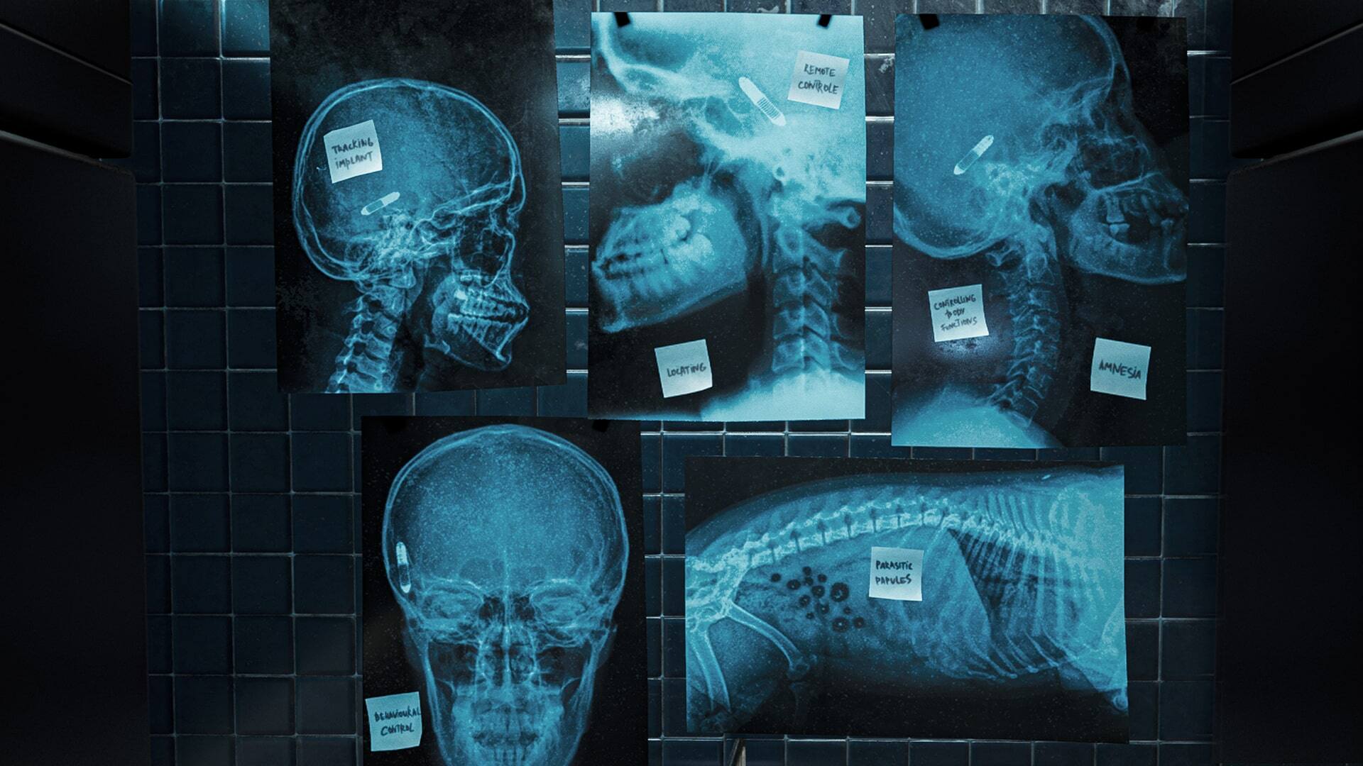 TRACKING IMPLANT  
REMOTE CONTROL  
CONTROLLING A OPER FINK!  
HAVS  
LOCATING  
AMNESIA  
PARASITIC PAPULES  
DERAVOURAL CONTROL