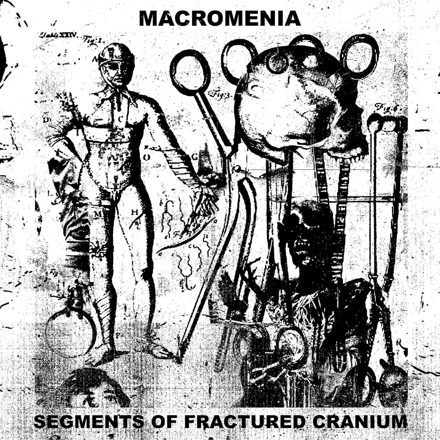 MACROMENIA

SEGMENTS OF FRACTURED CRANIUM