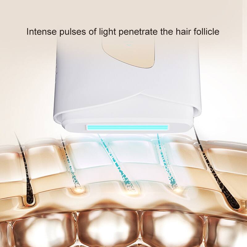 Intense pulses of light penetrate the hair follicle