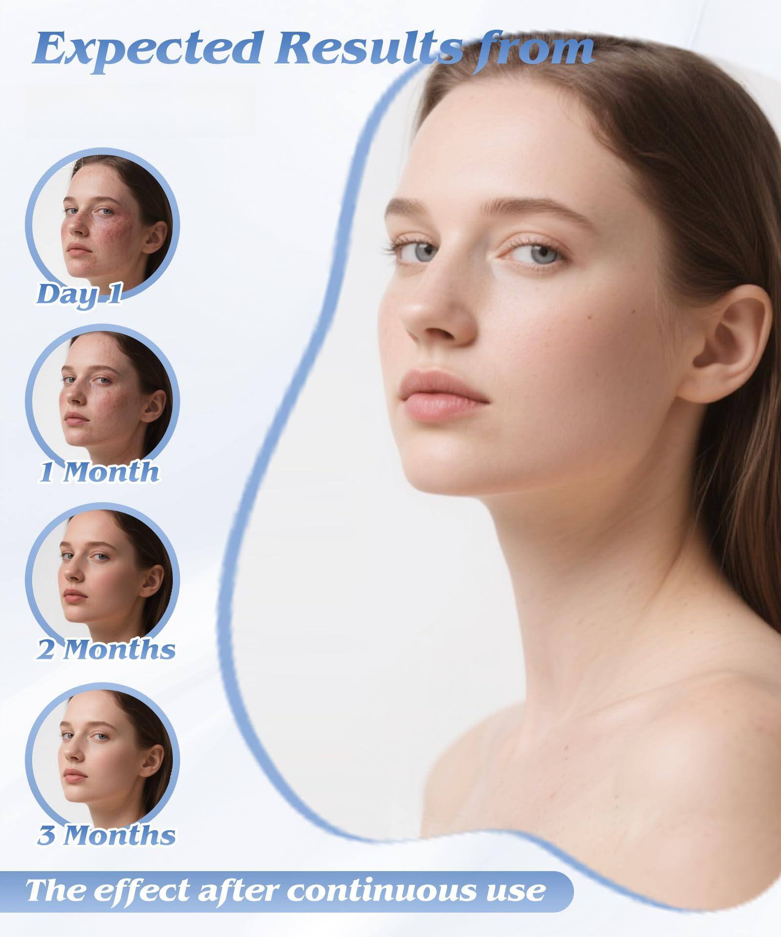Expected Results from

- Day 1
- 1 Month
- 2 Months
- 3 Months

The effect after continuous use