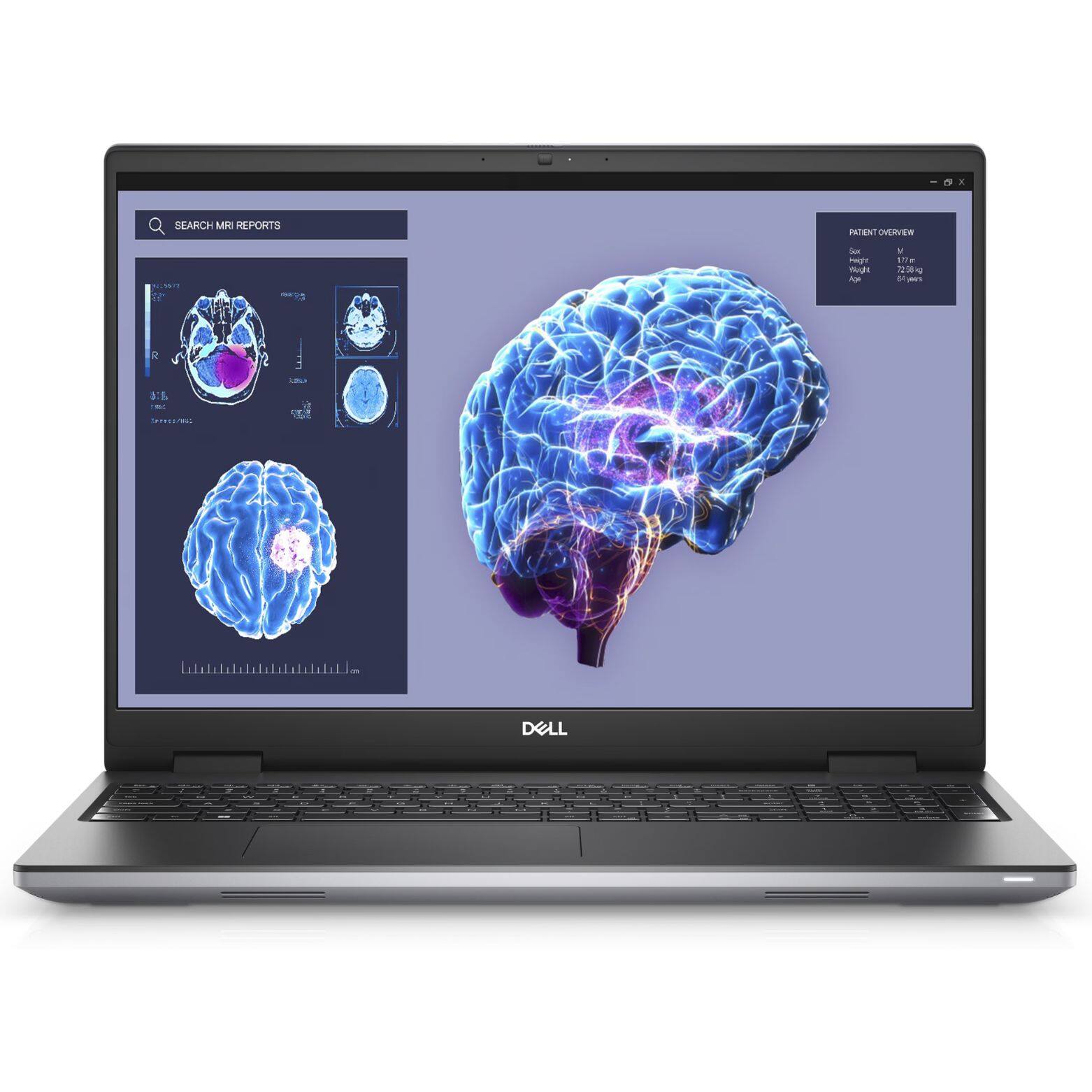 - 6 X
SEARCH MRI REPORTS
PATIENT OVERVIEW
500
Spec Sugt Rige
V the 72:58 kg 84 years
R
-
57g
SPECIA
DELL
-