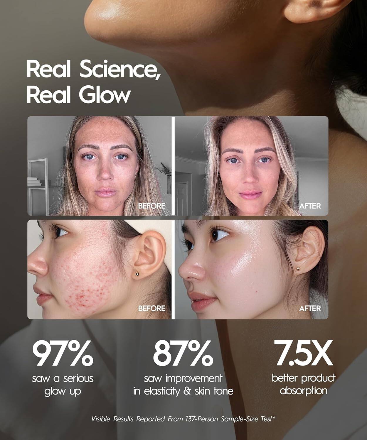 Real Science, Real Glow

BEFORE AFTER  
BEFORE AFTER

97% saw a serious glow up  
87% saw improvement in elasticity & skin tone  
7.5X better product absorption  

Visible Results Reported From 137-Person Sample-Size Test*