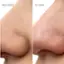 BEFORE AFTER