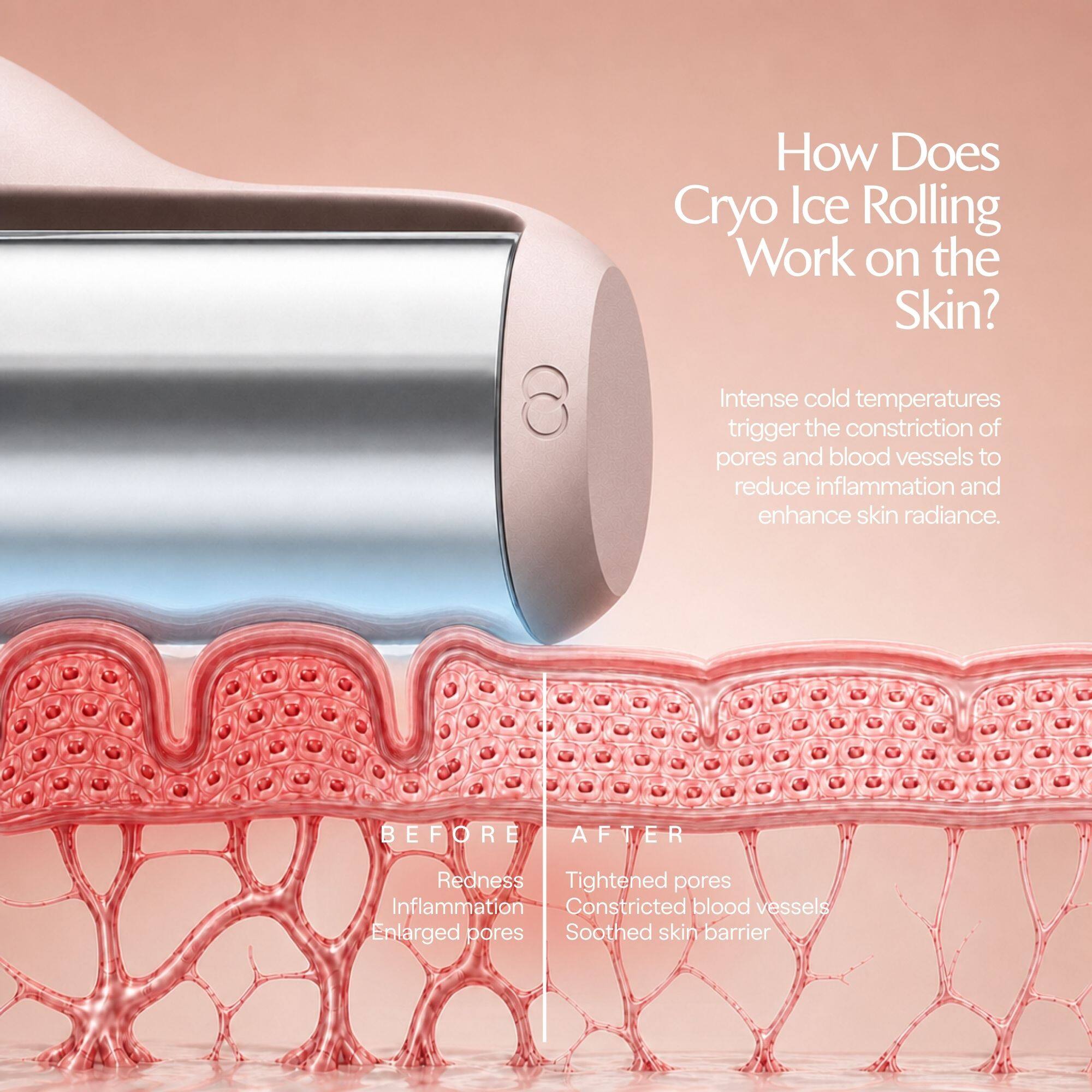 How Does Cryo Ice Rolling Work on the Skin?

Intense cold temperatures trigger the constriction of pores and blood vessels to reduce inflammation and enhance skin radiance.

BEFORE
- Redness
- Inflammation
- Enlarged pores

AFTER
- Tightened pores
- Constricted blood vessels
- Soothed skin barrier