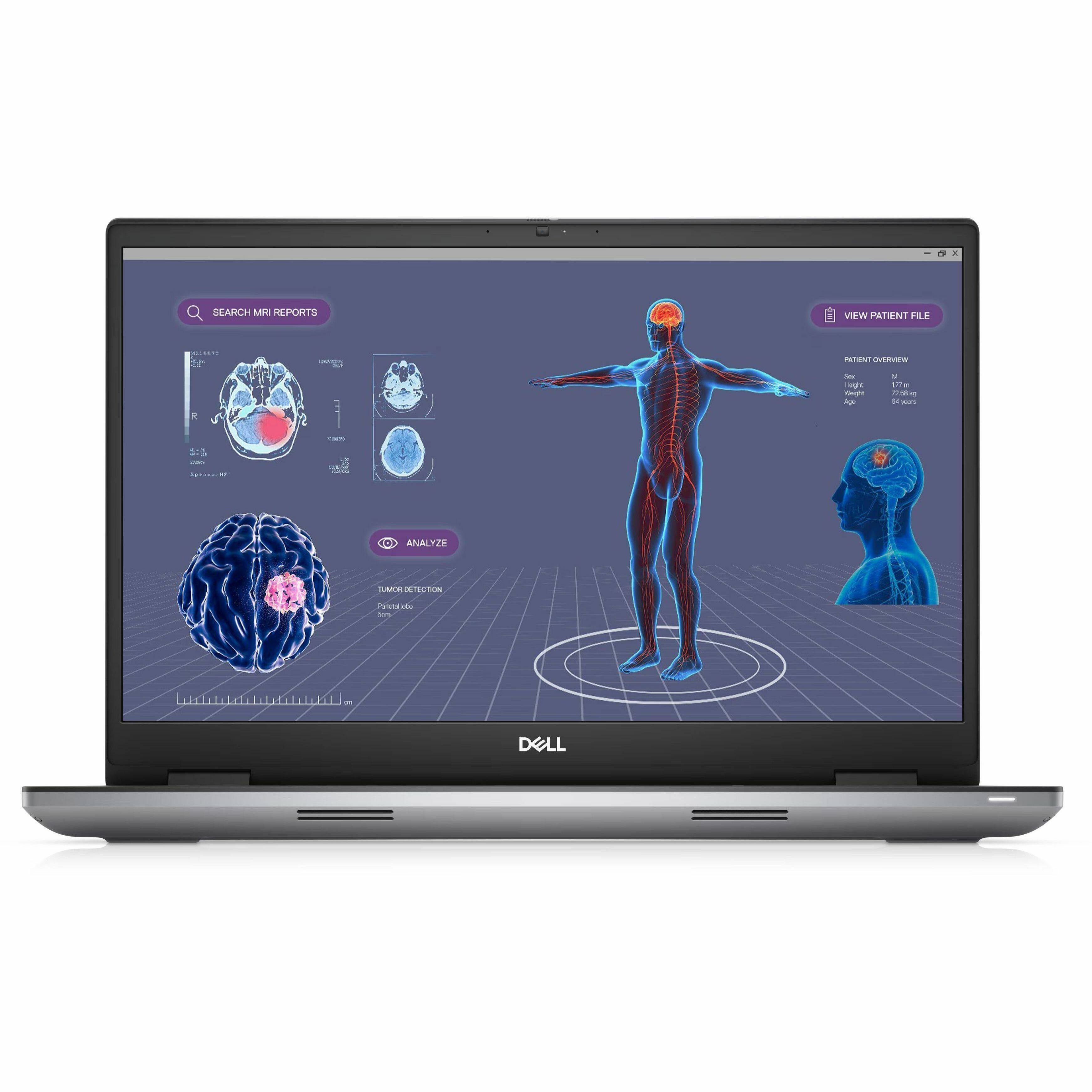 - SEARCH MRI REPORTS  
- VIEW PATIENT FILE  
- ANALYZE  
- TUMOR DETECTION  
- PATIENT OVERVIEW  
- AGE: 60 years  
- WEIGHT: 77 kg  
- HEIGHT: 177 cm