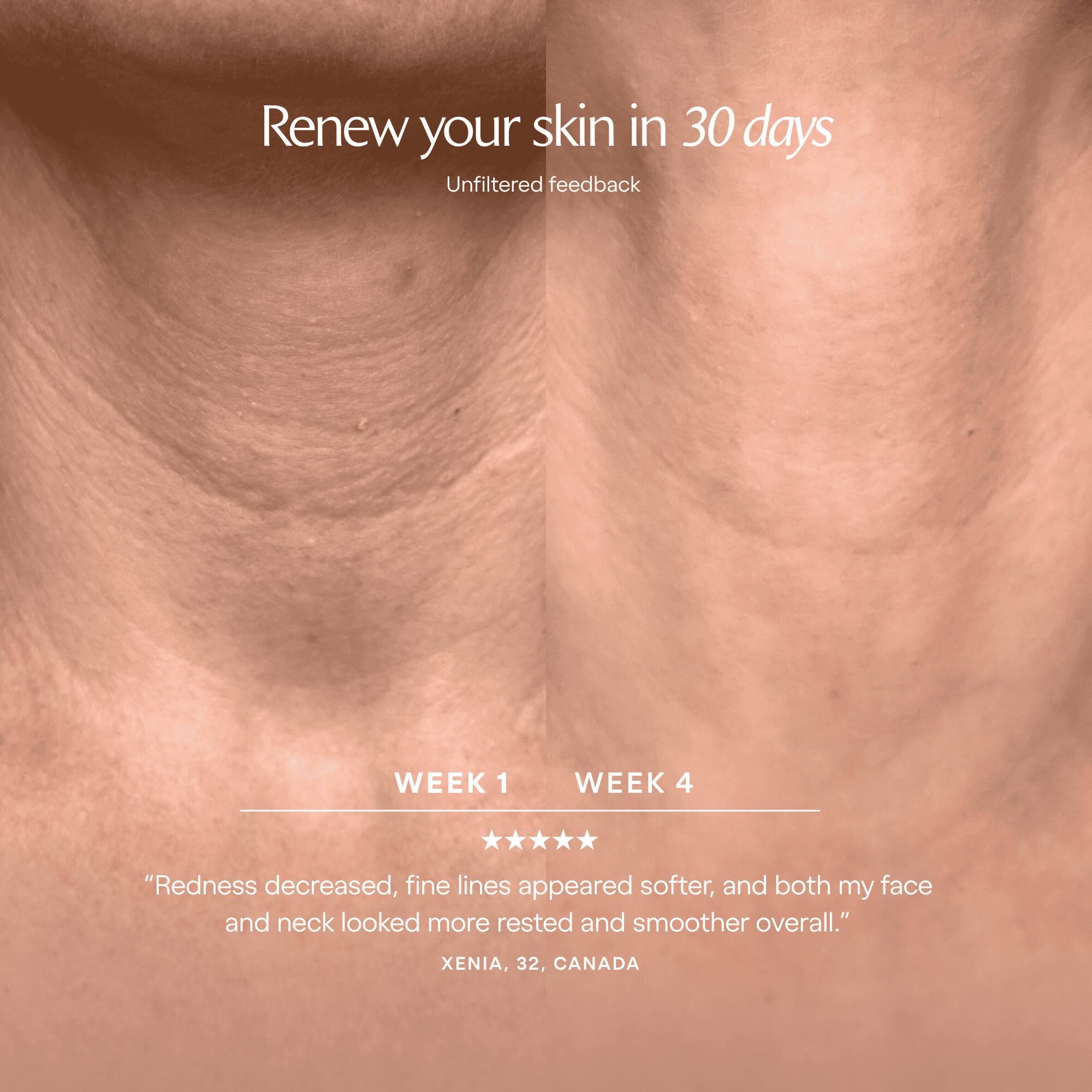 Renew your skin in 30 days  
Unfiltered feedback

WEEK 1  
WEEK 4

"Redness decreased, fine lines appeared softer, and both my face and neck looked more rested and smoother overall."  
XENIA, 32, CANADA