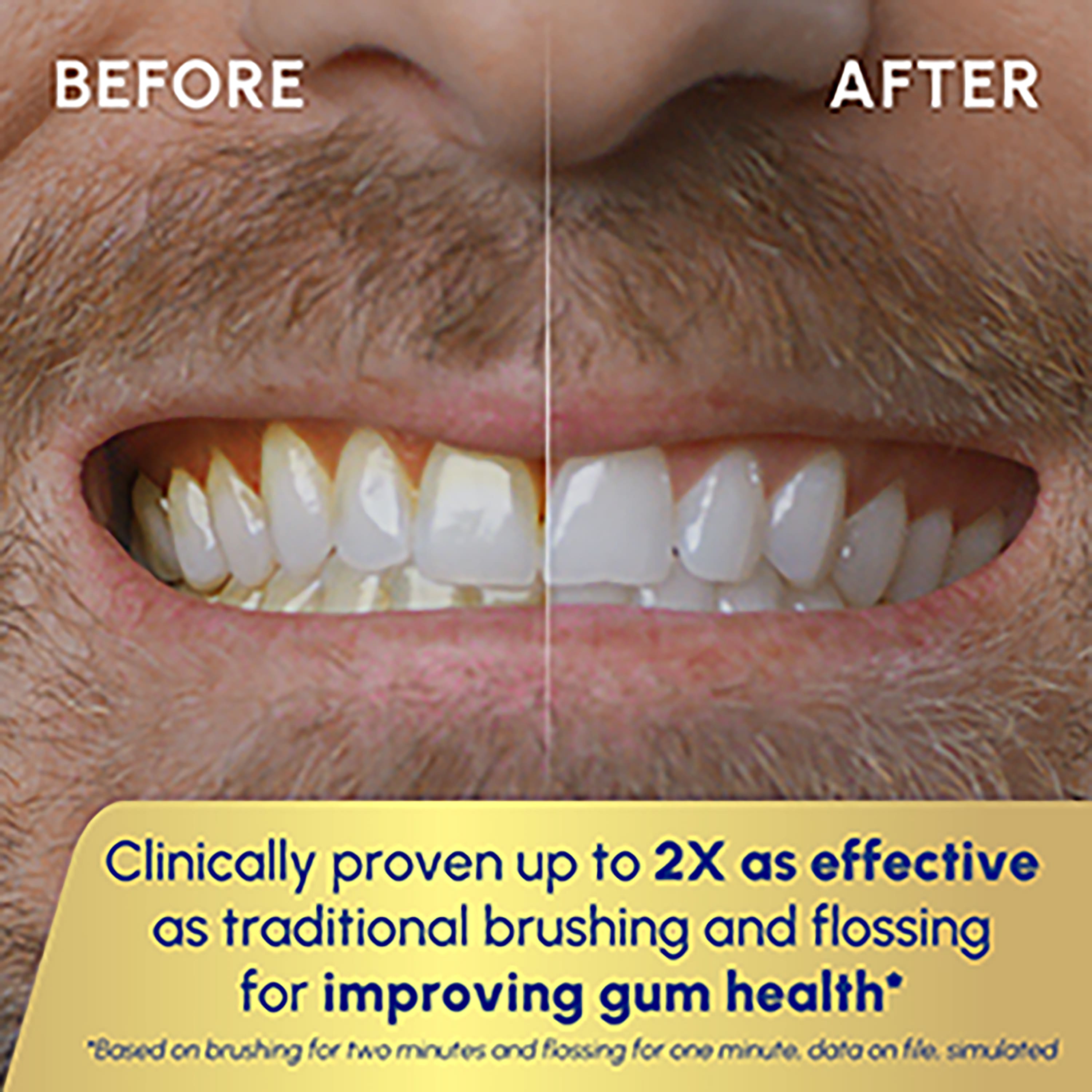 BEFORE AFTER Clinically proven up to 2X as effective as traditional brushing and flossing for improving gum health* "Based on brushing for two minutes and flossing for one minute. data on file. simulated