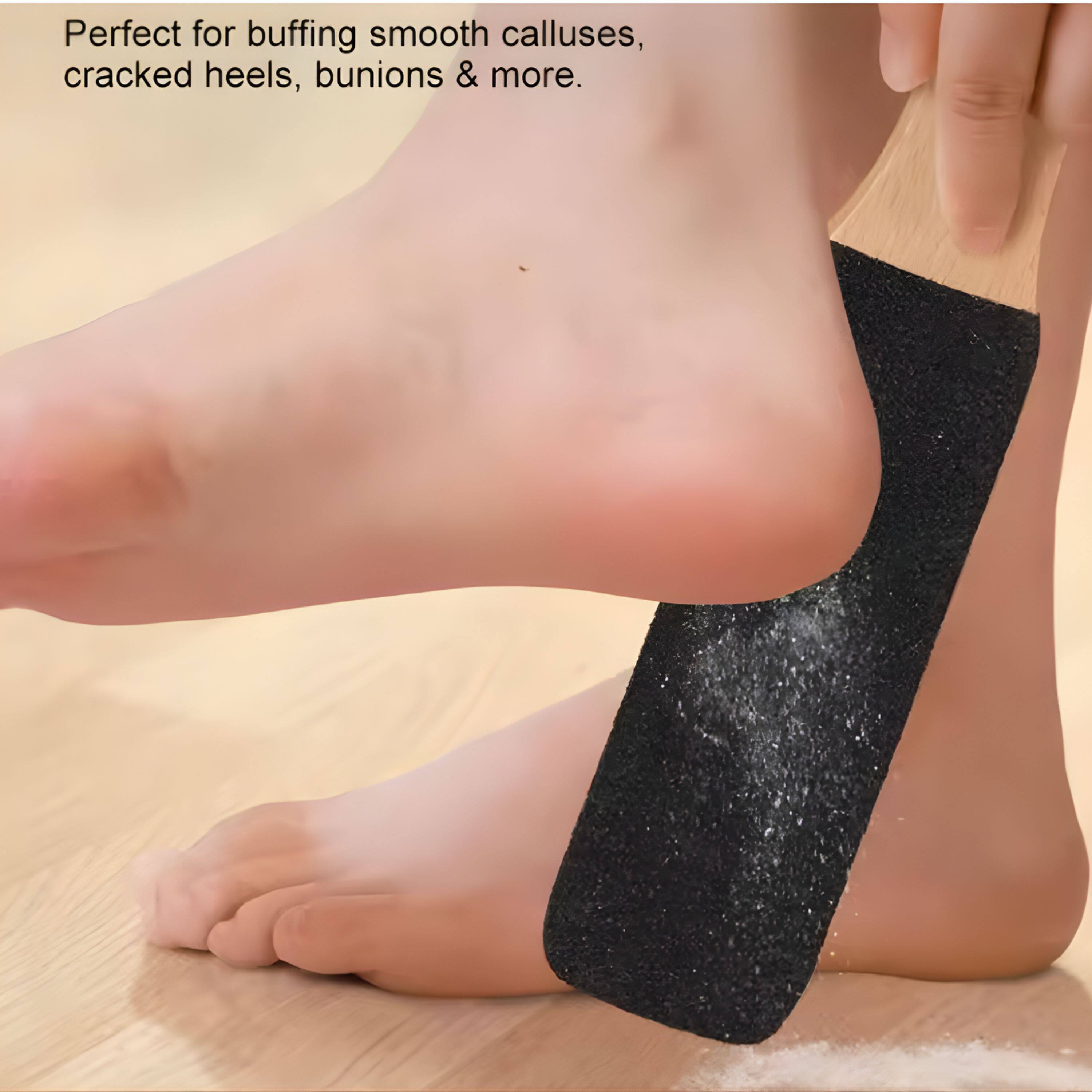 Perfect for buffing smooth calluses, cracked heels, bunions & more.