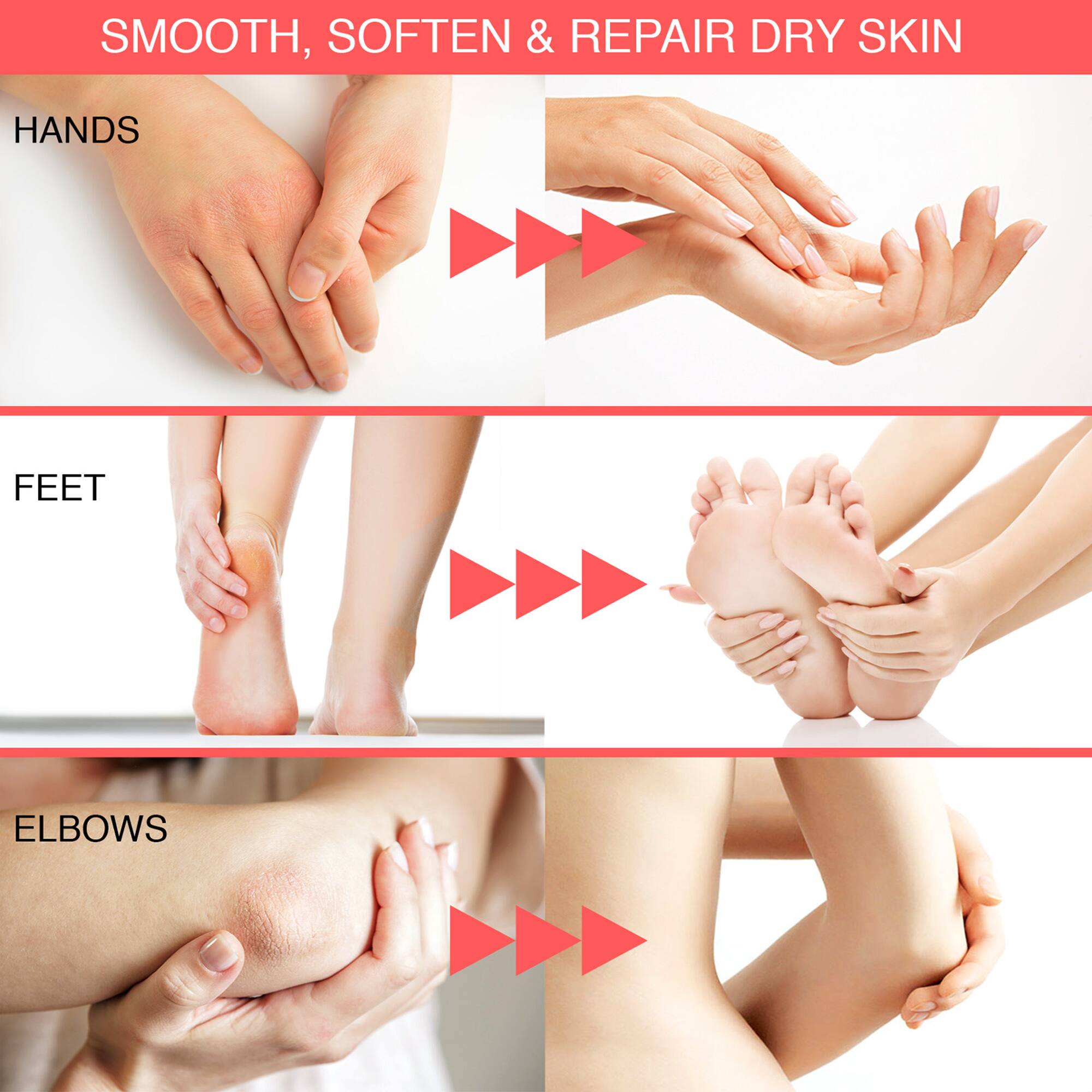 SMOOTH, SOFTEN & REPAIR DRY SKIN

HANDS

FEET

ELBOWS