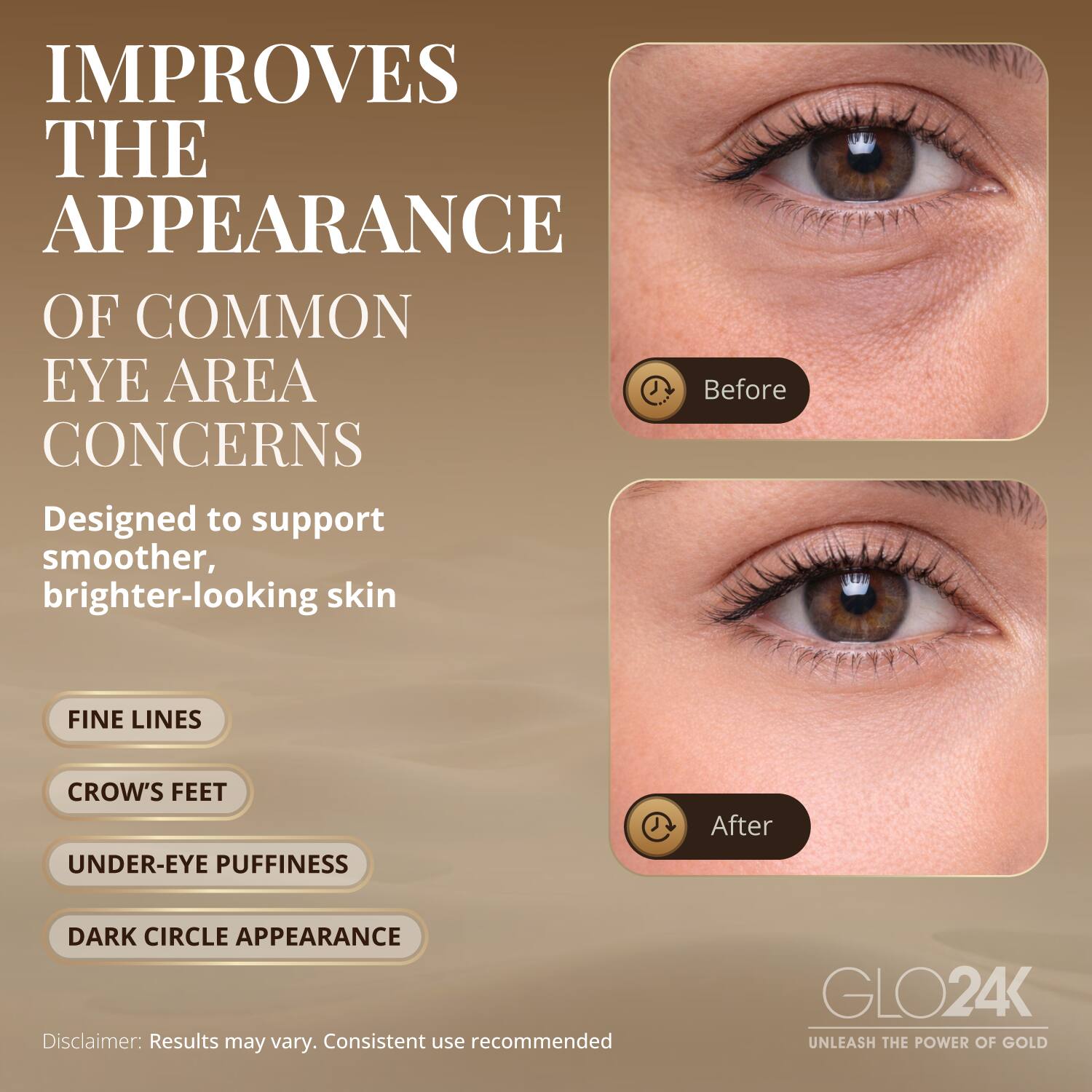 IMPROVES THE APPEARANCE OF COMMON EYE AREA CONCERNS

Designed to support smoother, brighter-looking skin

- FINE LINES
- CROW'S FEET
- UNDER-EYE PUFFINESS
- DARK CIRCLE APPEARANCE

Disclaimer: Results may vary. Consistent use recommended

GLO24K
UNLEASH THE POWER OF GOLD