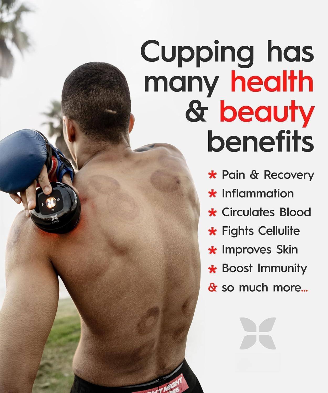 Cupping has many health & beauty benefits

- Pain & Recovery
- Inflammation
- Circulates Blood
- Fights Cellulite
- Improves Skin
- Boost Immunity
- & so much more...