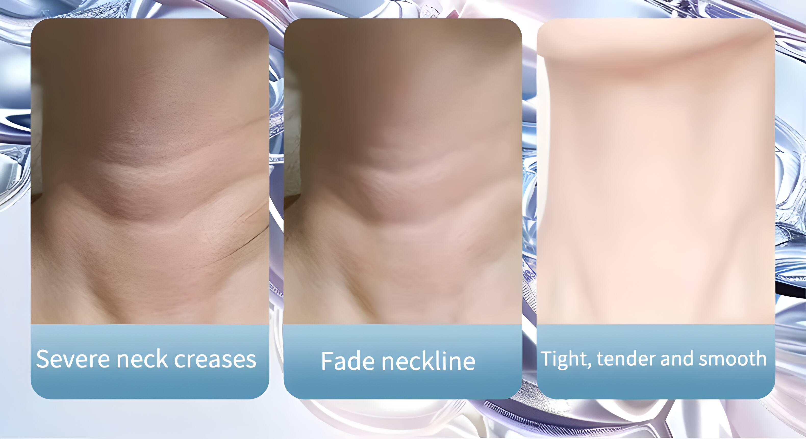 Severe neck creases  
Fade neckline  
Tight, tender and smooth