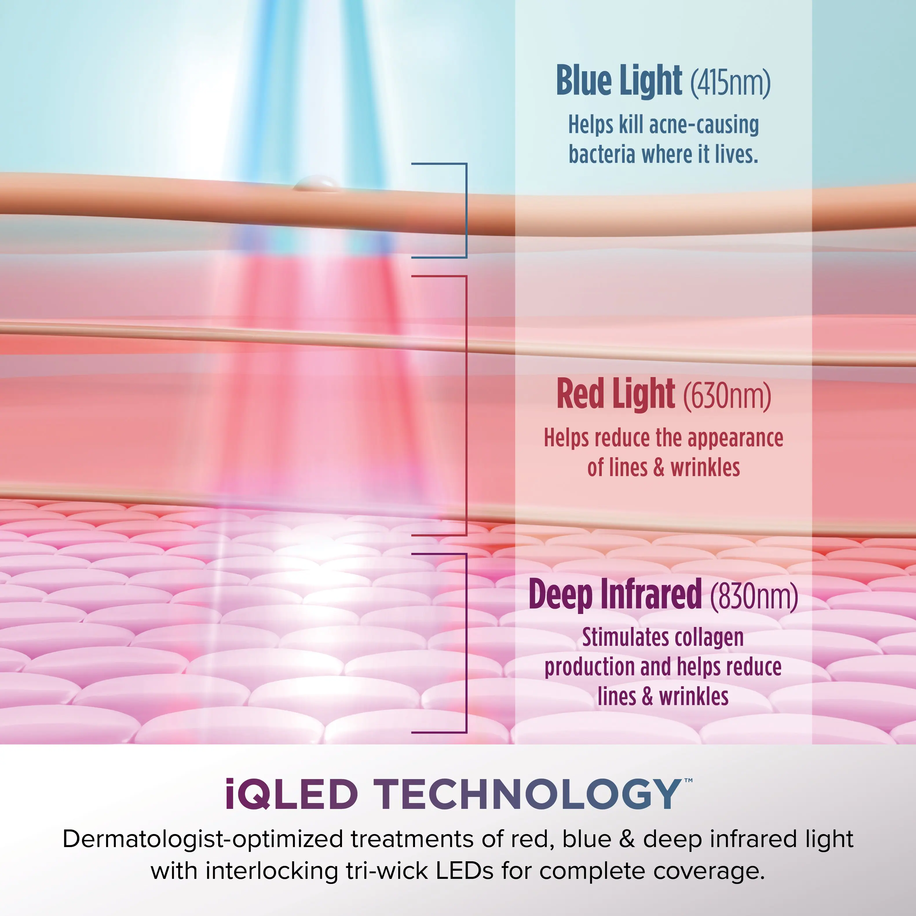Blue Light (415nm) helps kill acne-causing bacteria where it lives.  
Red Light (630nm) helps reduce the appearance of lines & wrinkles.  
Deep Infrared (830nm) stimulates collagen production and helps reduce lines & wrinkles.  

iQLED TECHNOLOGY: Dermatologist-optimized treatments of red, blue & deep infrared light with interlocking tri-wick LEDs for complete coverage.