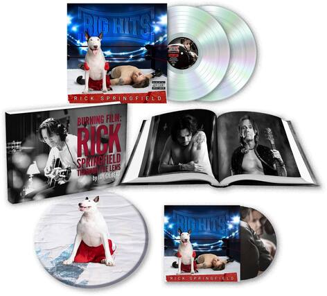 RIG HITS
RICK SPRINGFIELD
BURNING FILM: RICK SPRINGFIELD THROUGH THE LENS by JAY GILBERT
RIG HITS
RICK SPRINGFIELD