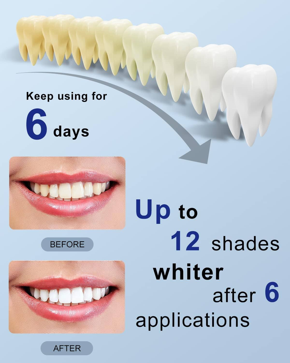 Keep using for 6 days

BEFORE

AFTER

Up to 12 shades whiter after 6 applications