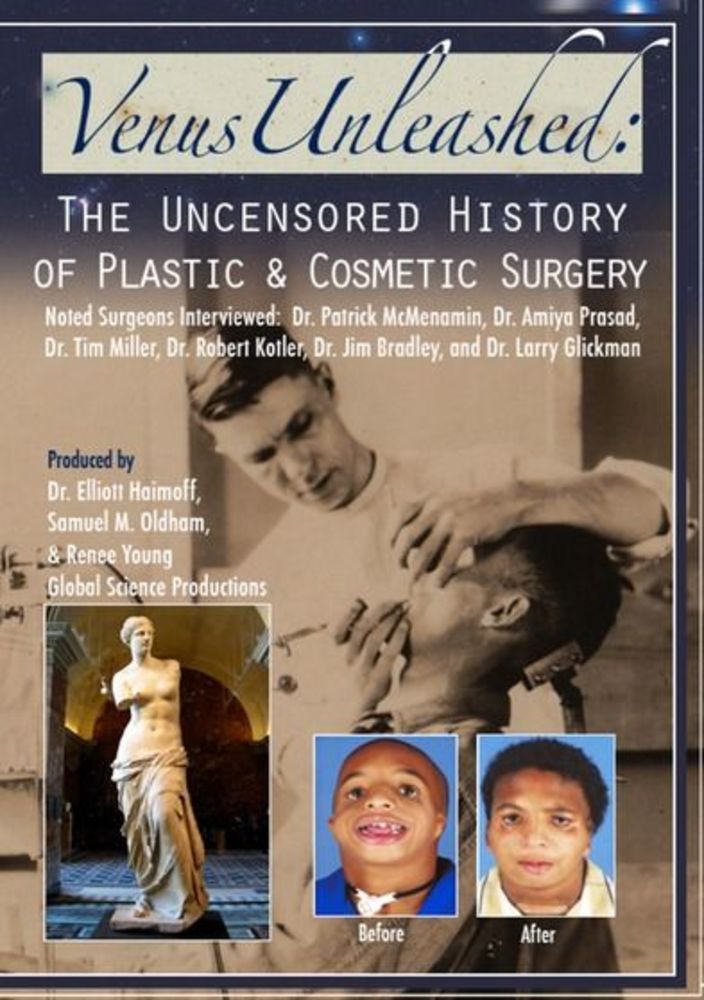 Best Buy: Venus Unleashed: The Uncensored History of Plastic & Cosmetic  Surgery [DVD]