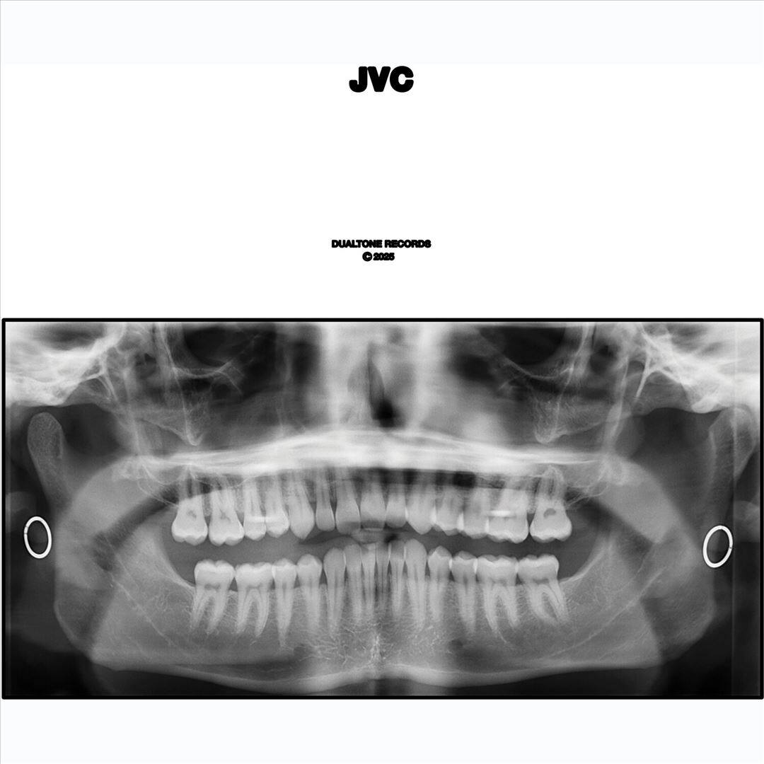JVC [LP] [VINYL] price history on PriceWatchPro