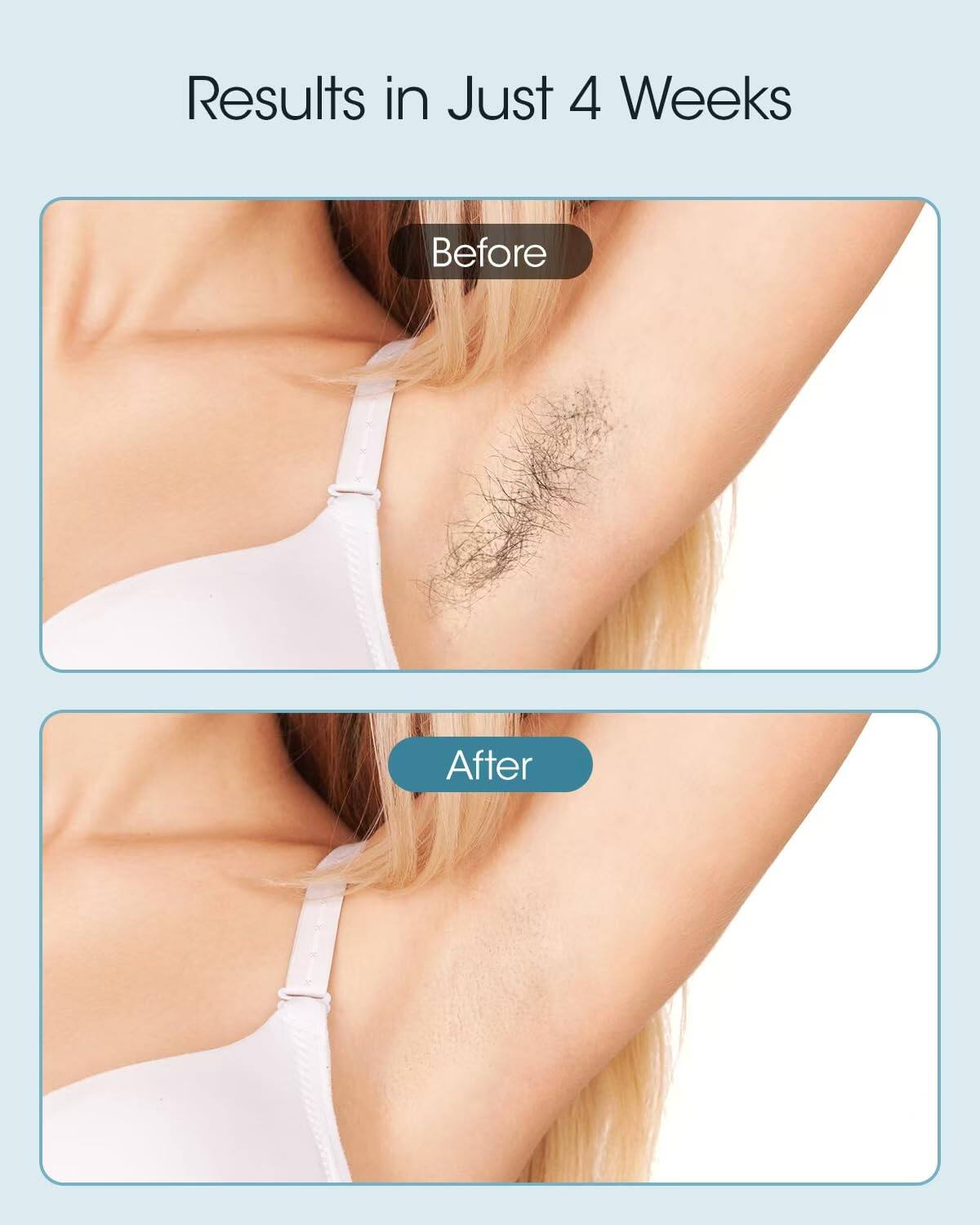 Results in Just 4 Weeks

Before

After