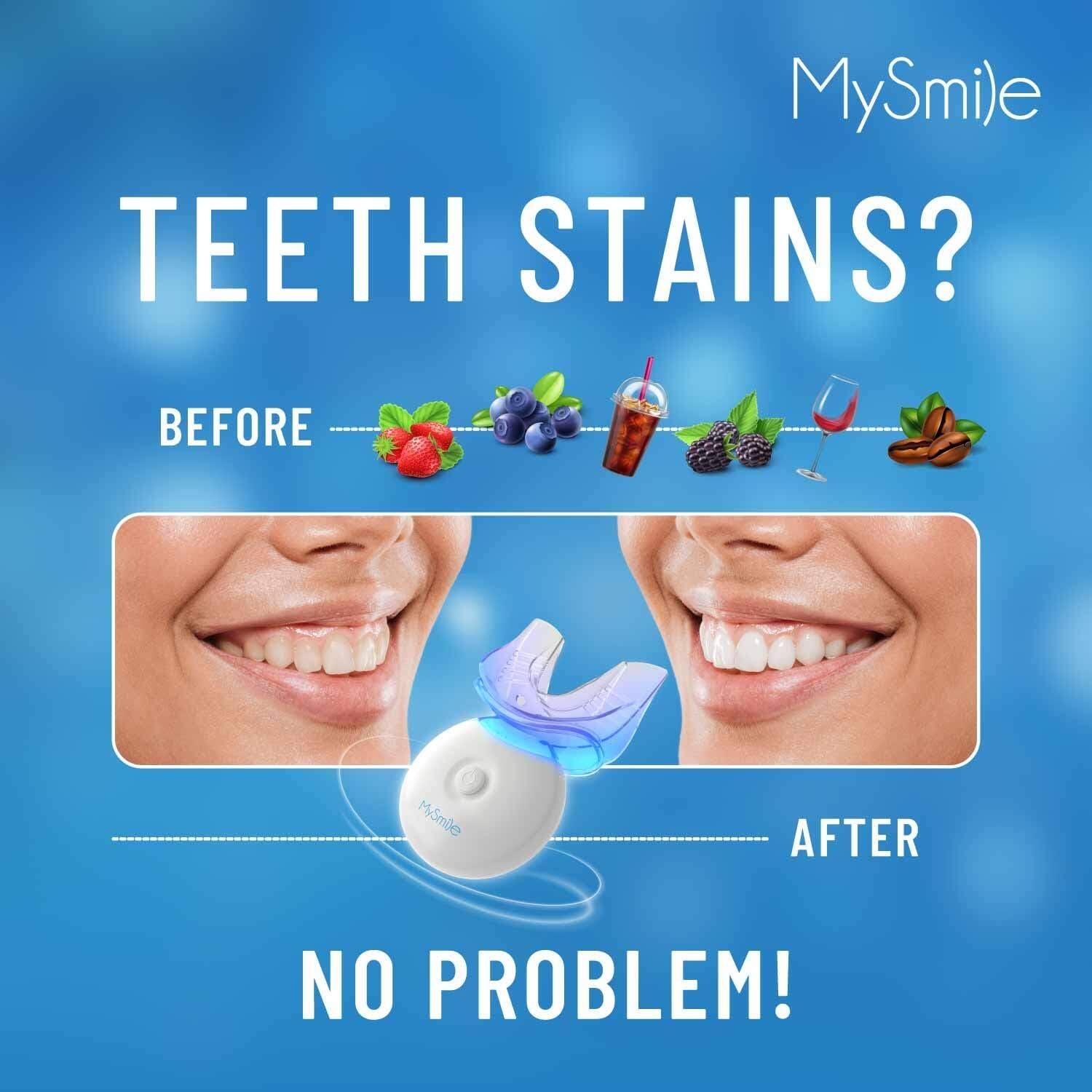 MySmile TEETH STAINS? BEFORE AFTER NO PROBLEM!