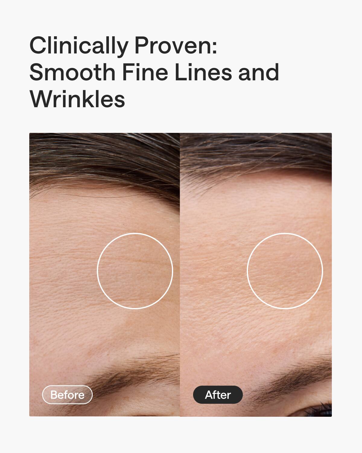 Clinically Proven:  
Smooth Fine Lines and Wrinkles  

Before  
After