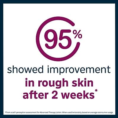 95% showed improvement in rough skin after 2 weeks*

*From a self-perception assessment for Advanced Therapy Lotion when used twice daily, based on average consumer usage.