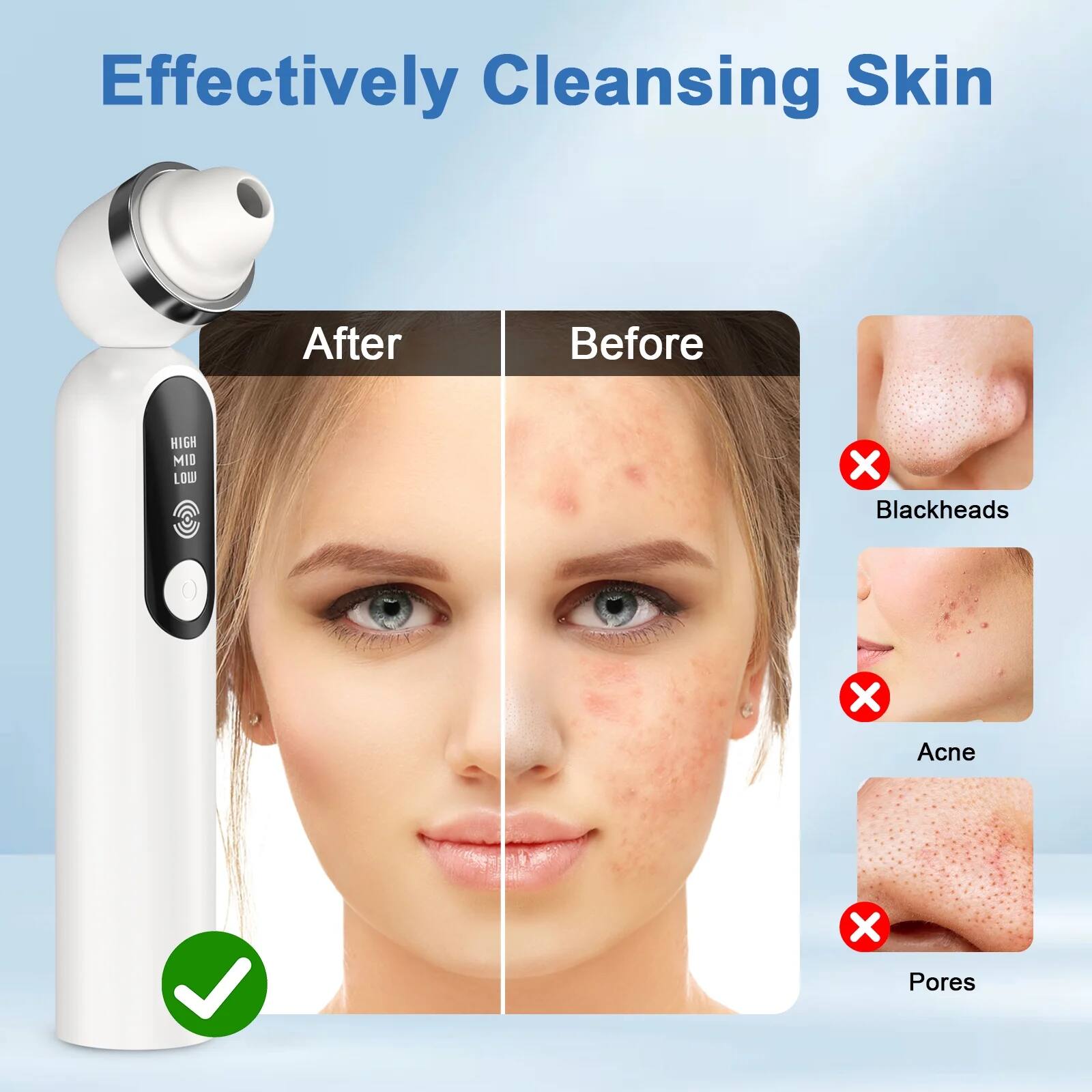 Effectively Cleansing Skin

After Before

HIGH MID LOW

Blackheads Acne Pores