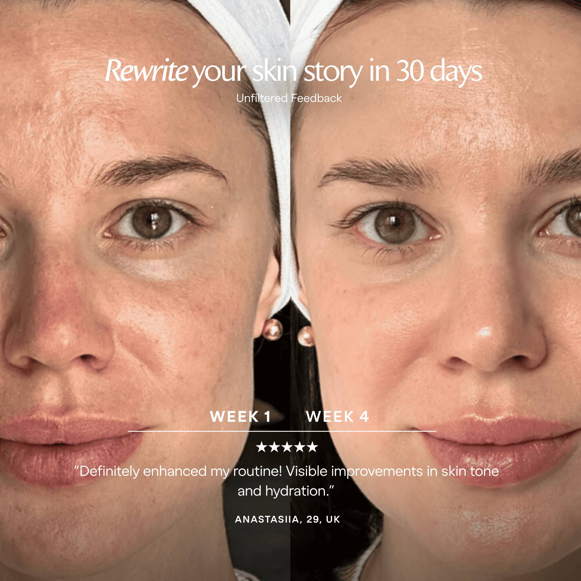 Rewrite your skin story in 30 days  
Unfiltered Feedback

WEEK 1  
"Definitely enhanced my routine! Visible improvements in skin tone and hydration."  
ANASTASIIA, 29, UK

WEEK 4  
"Visible improvements in skin tone and hydration."