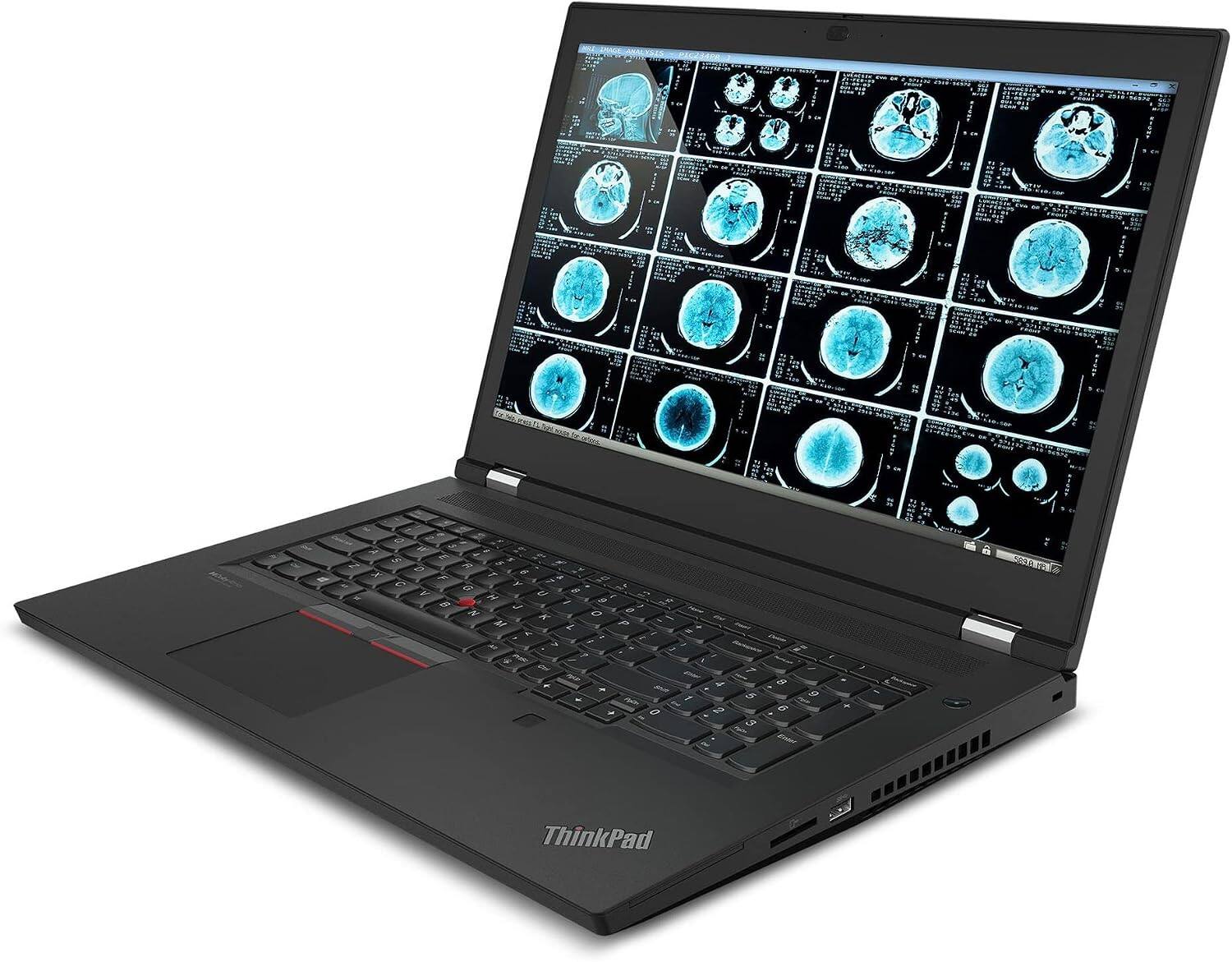 0 is 500001001 V - -Y & 1 S 0 0 A / - - LE the - X 1 - - - R 8 9 ThinkPad