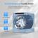 Forward & Reverse Tumble Action
Prevent tangling, effectively removing wrinkles & restoring fluffy and soft clothes
- Avoid entanglement
- 3D Somersault
- Fluffy & Soft