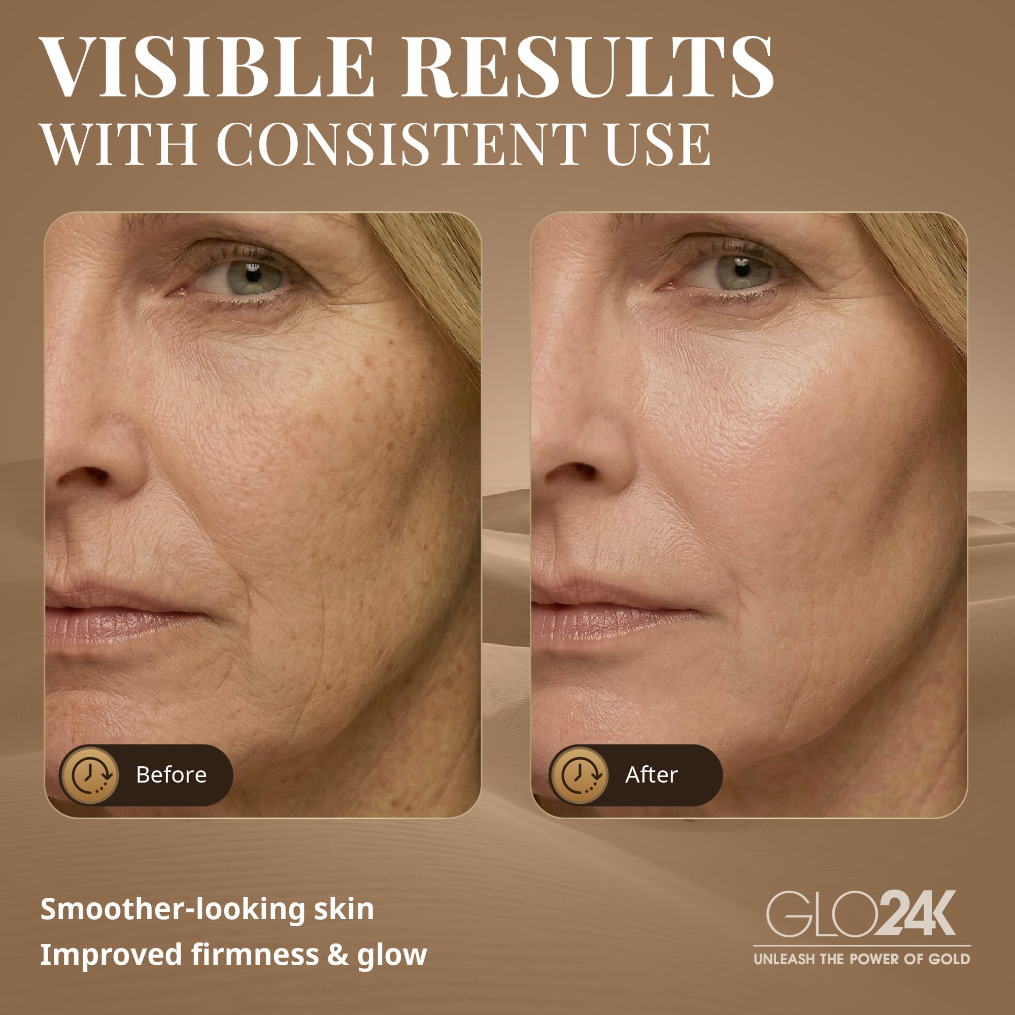 GLO24K Skin Rejuvenation Beauty Device BD1 - Best Buy