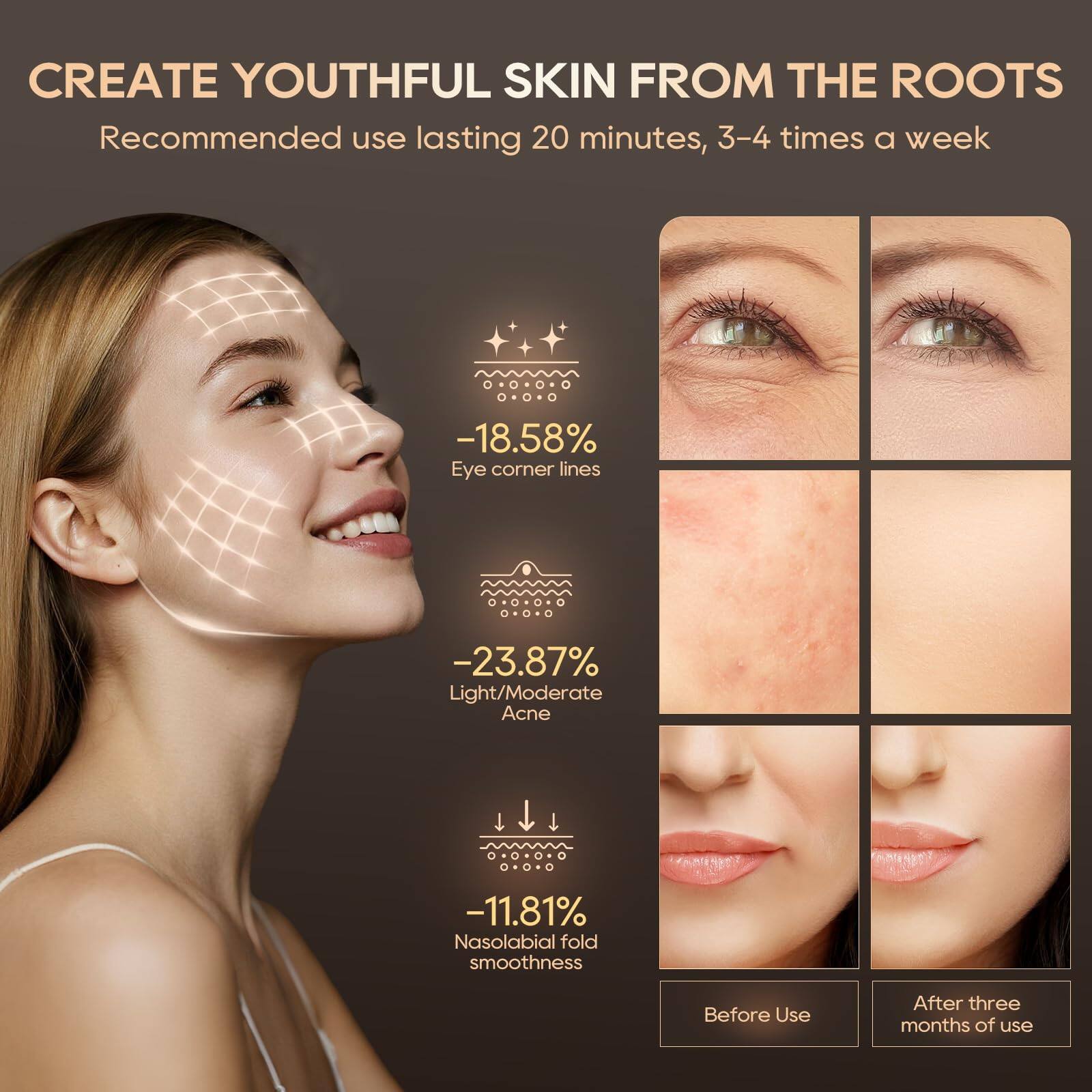 CREATE YOUTHFUL SKIN FROM THE ROOTS

Recommended use lasting 20 minutes, 3-4 times a week

-18.58% Eye corner lines
-23.87% Light/Moderate Acne
-11.81% Nasolabial fold smoothness

Before Use After three months of use