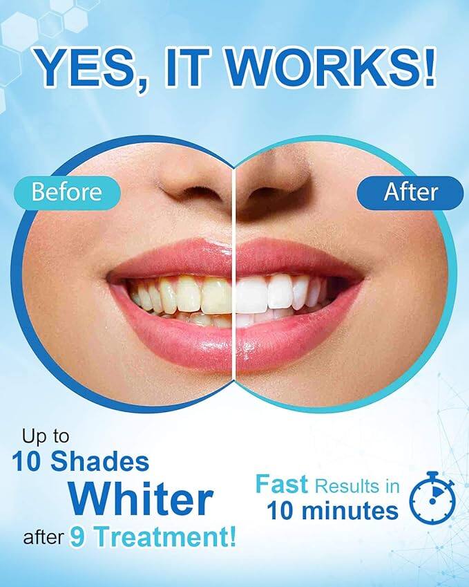 YES, IT WORKS! Before After Up to 10 Shades Whiter after 9 Treatment! Fast Results in 10 minutes