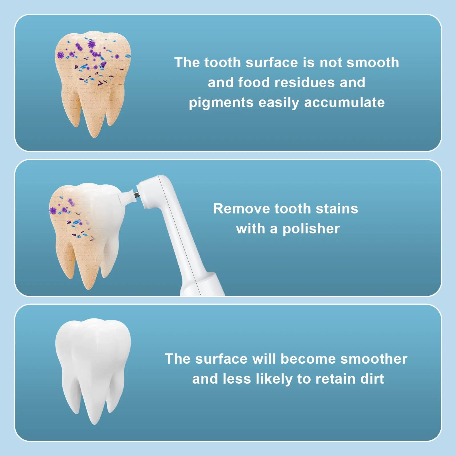 The tooth surface is not smooth and food residues and pigments easily accumulate.

Remove tooth stains with a polisher.

The surface will become smoother and less likely to retain dirt.