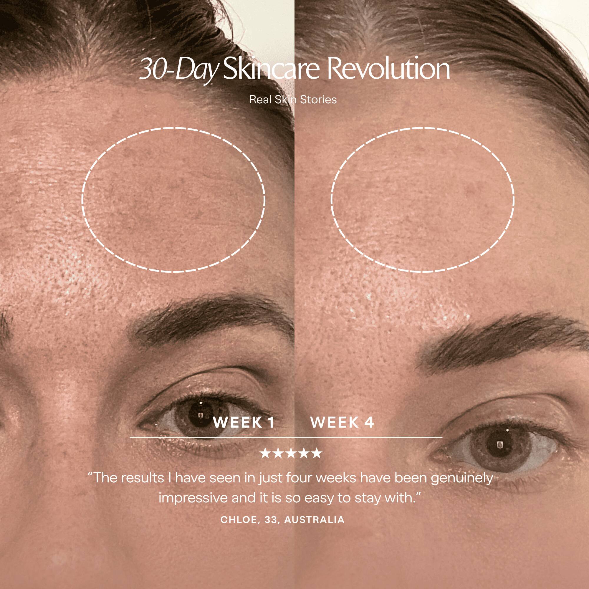 30-Day Skincare Revolution  
Real Skin Stories

WEEK 1  
WEEK 4

"The results I have seen in just four weeks have been genuinely impressive and it is so easy to stay with."  
CHLOE, 33, AUSTRALIA