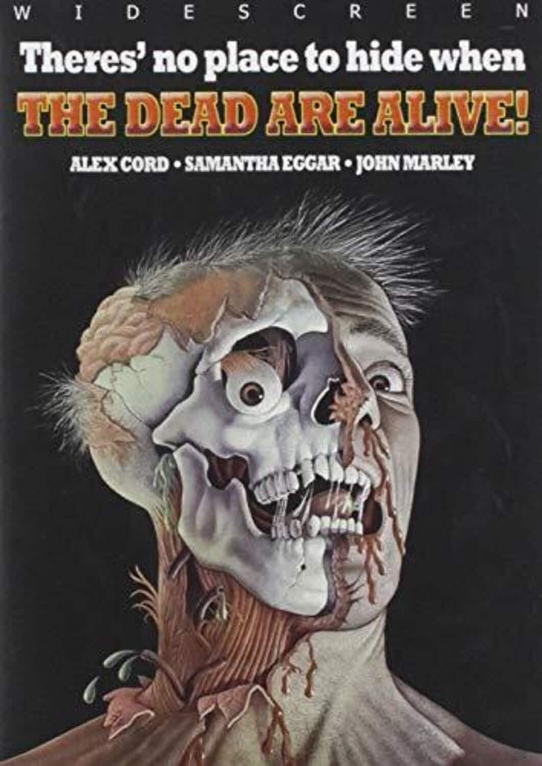 The Dead Are Alive  - DVD