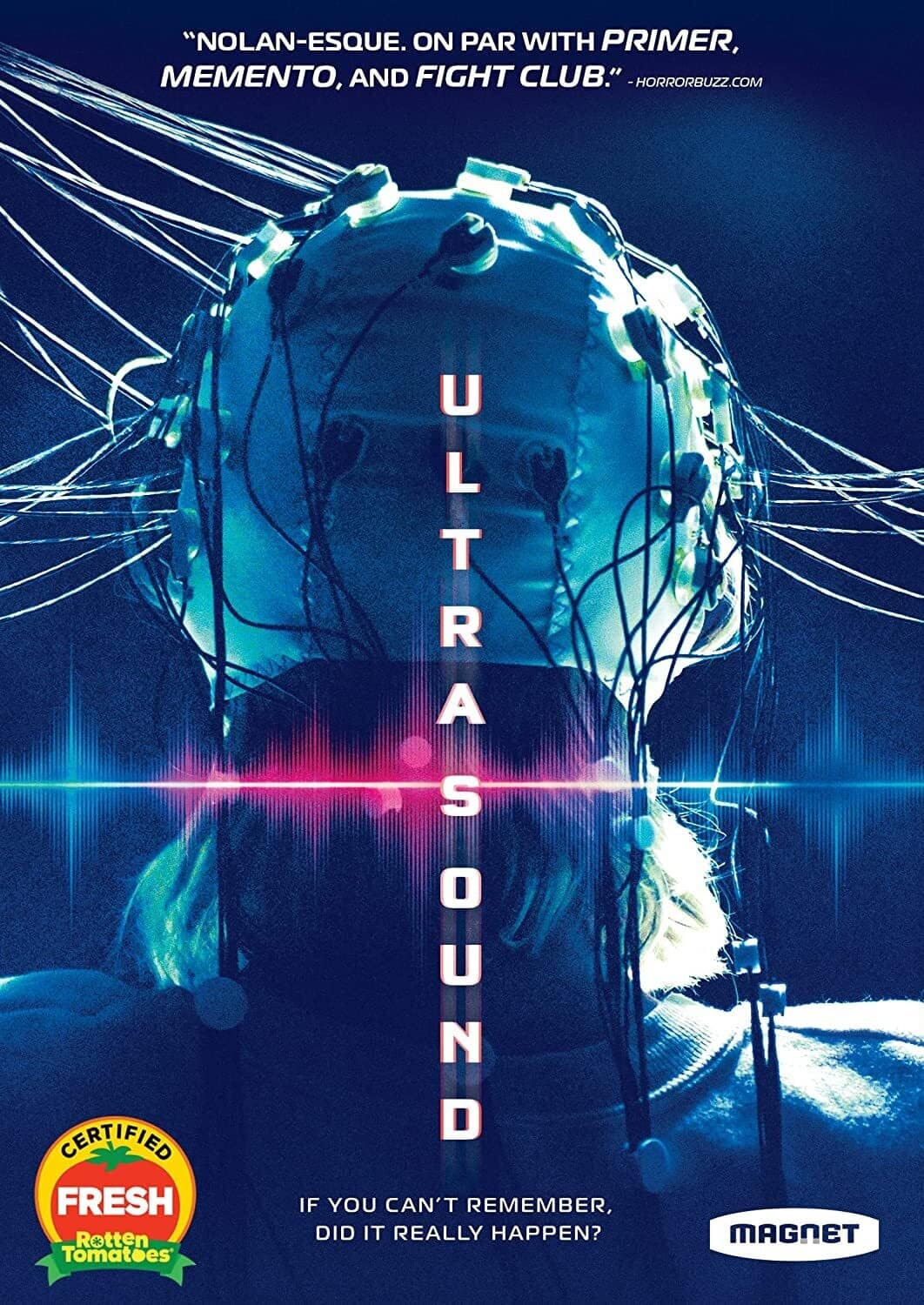 Ultrasound  - DVD