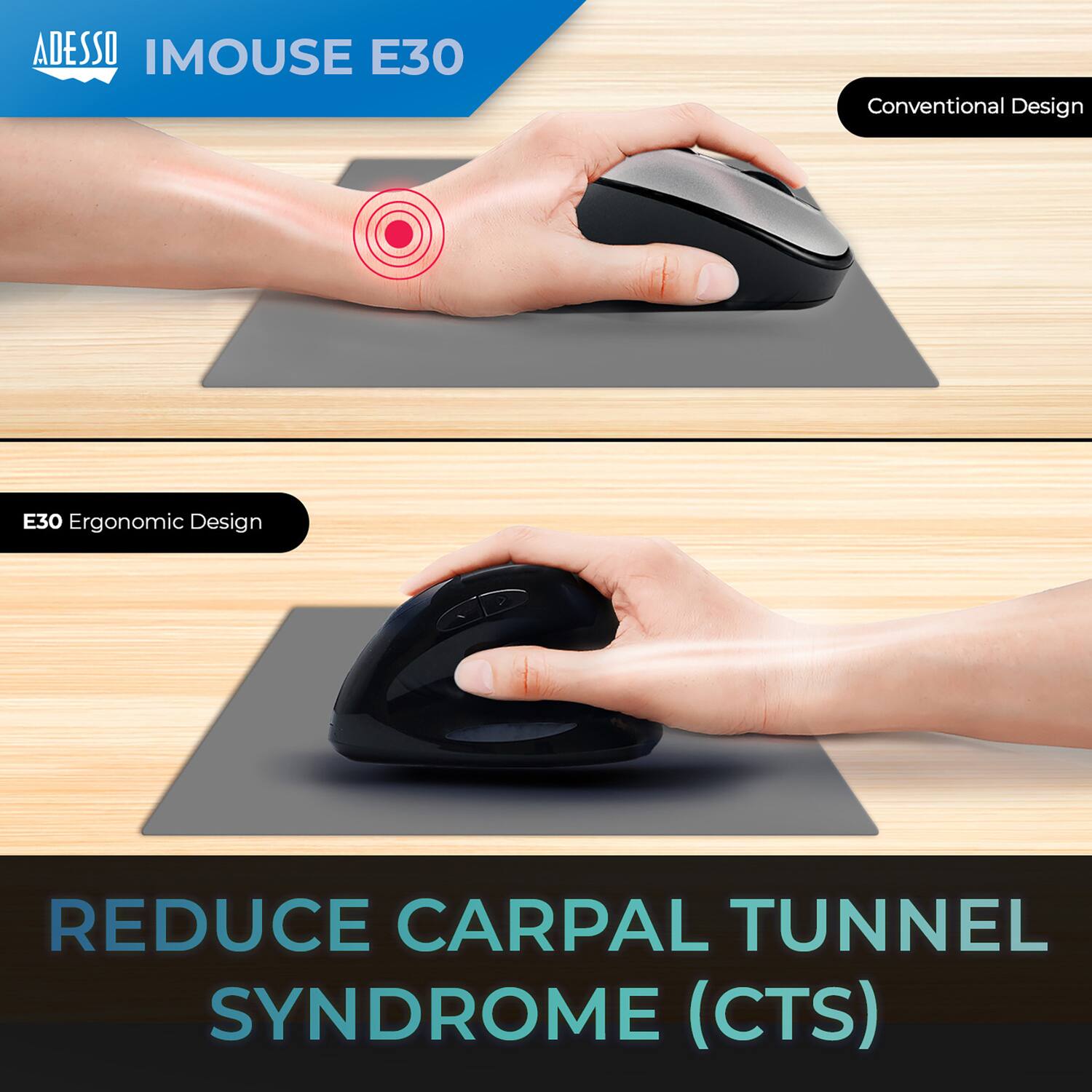 ADESSO IMOUSE E30

Conventional Design

E30 Ergonomic Design

REDUCE CARPAL TUNNEL SYNDROME (CTS)