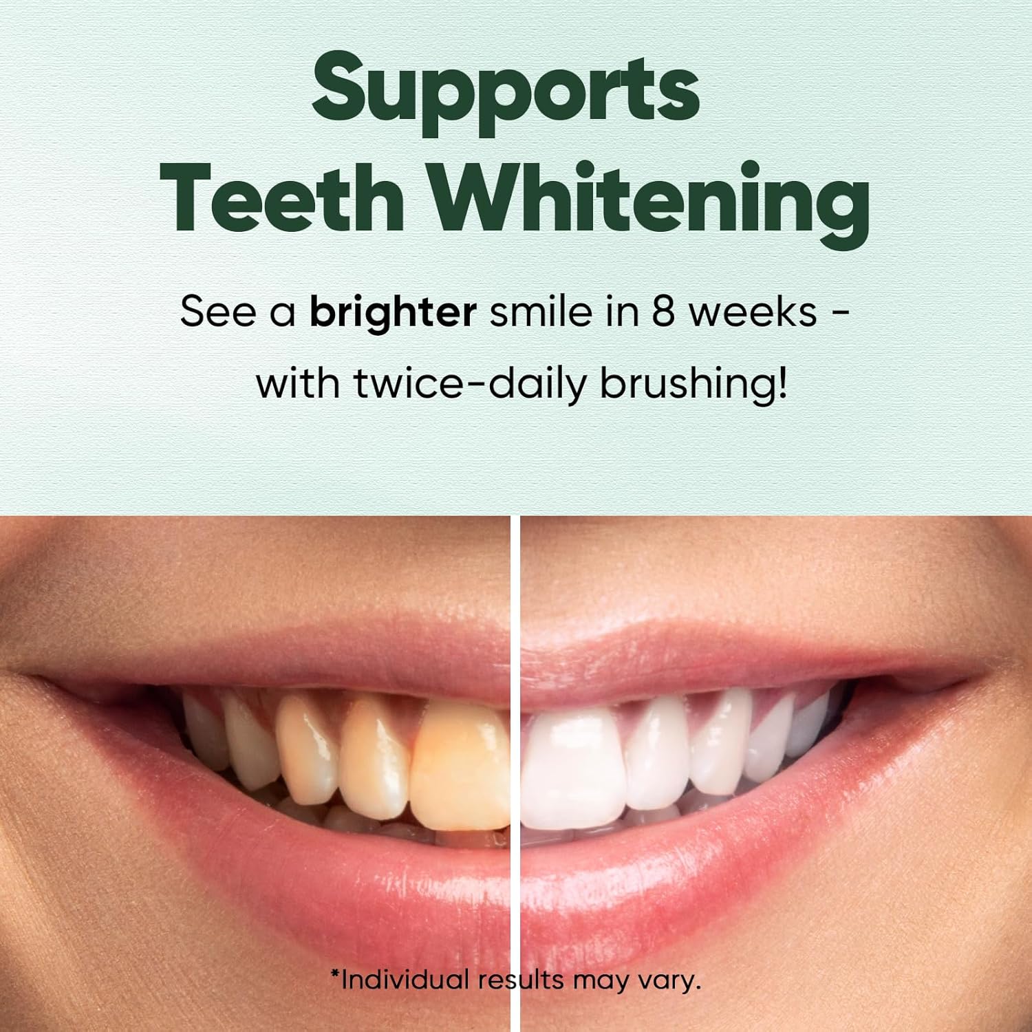 Supports Teeth Whitening  
See a brighter smile in 8 weeks - with twice-daily brushing!  
*Individual results may vary.