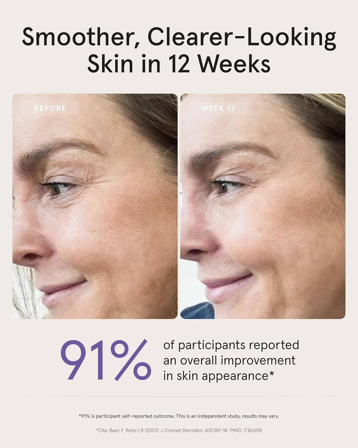 Smoother, Clearer-Looking Skin in 12 Weeks

BEFORE
WEEK 12

91% of participants reported an overall improvement in skin appearance*

*91% is participant self-reported outcome. This is an independent study, results may vary.
*Cite: Baez F, Reilly LR (2007). J Cosmet Dermatol. 6(3):189-94. PMID: 17760698