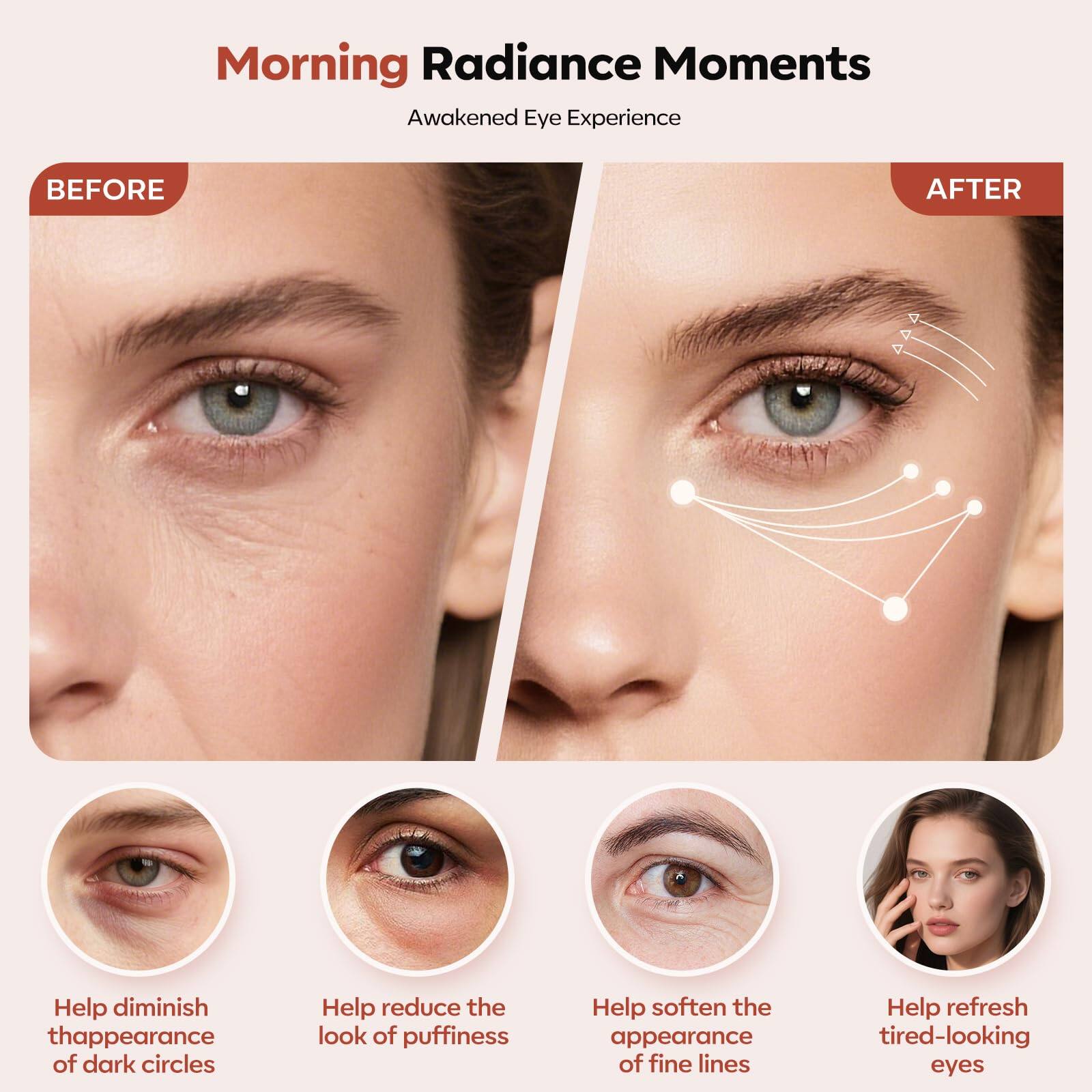 Morning Radiance Moments  
Awakened Eye Experience  

BEFORE  
AFTER  

Help diminish the appearance of dark circles  
Help reduce the look of puffiness  
Help soften the appearance of fine lines  
Help refresh tired-looking eyes