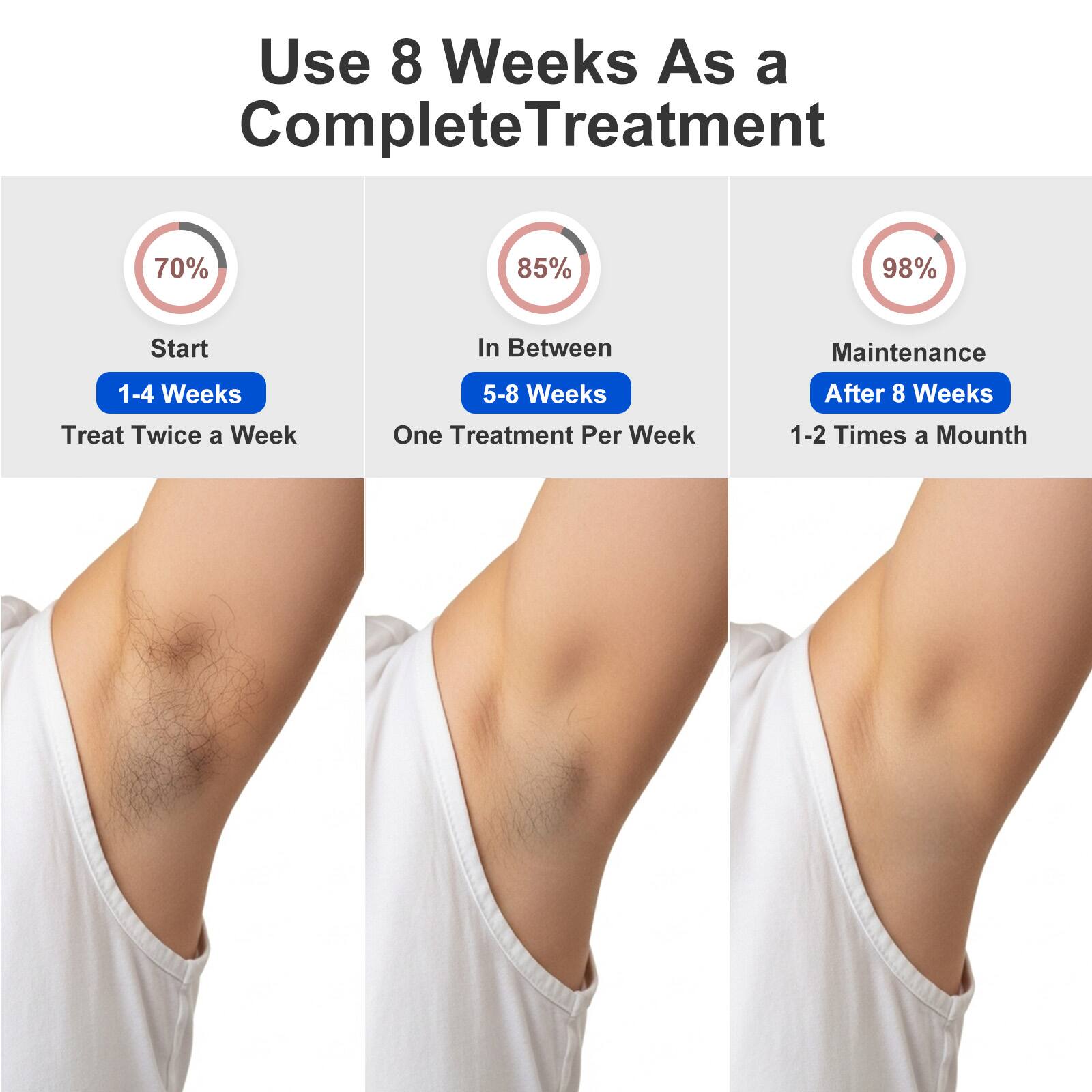 Use 8 Weeks As a Complete Treatment

- Start: 1-4 Weeks  
  Treat Twice a Week  
  70%

- In Between: 5-8 Weeks  
  One Treatment Per Week  
  85%

- Maintenance: After 8 Weeks  
  1-2 Times a Month  
  98%