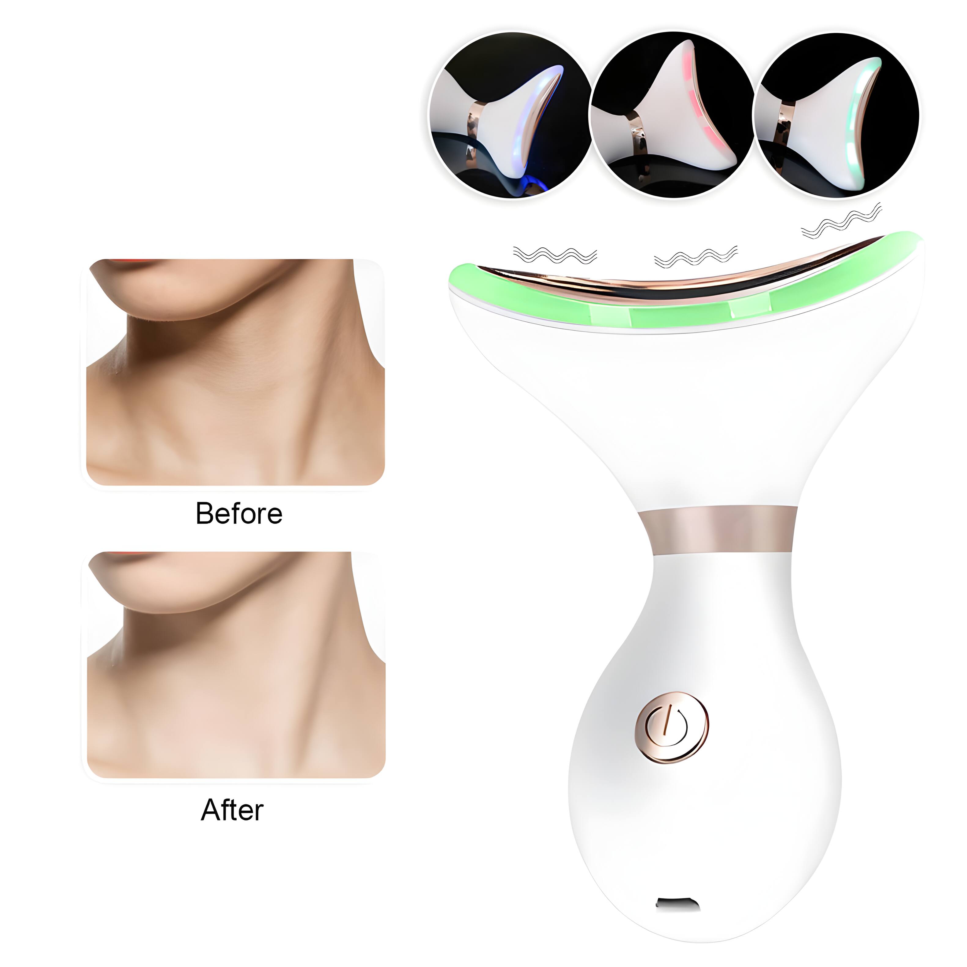Before After